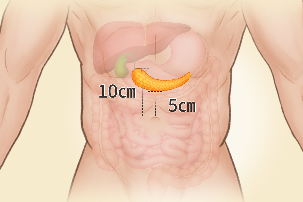 胰腺体表投影区位置图